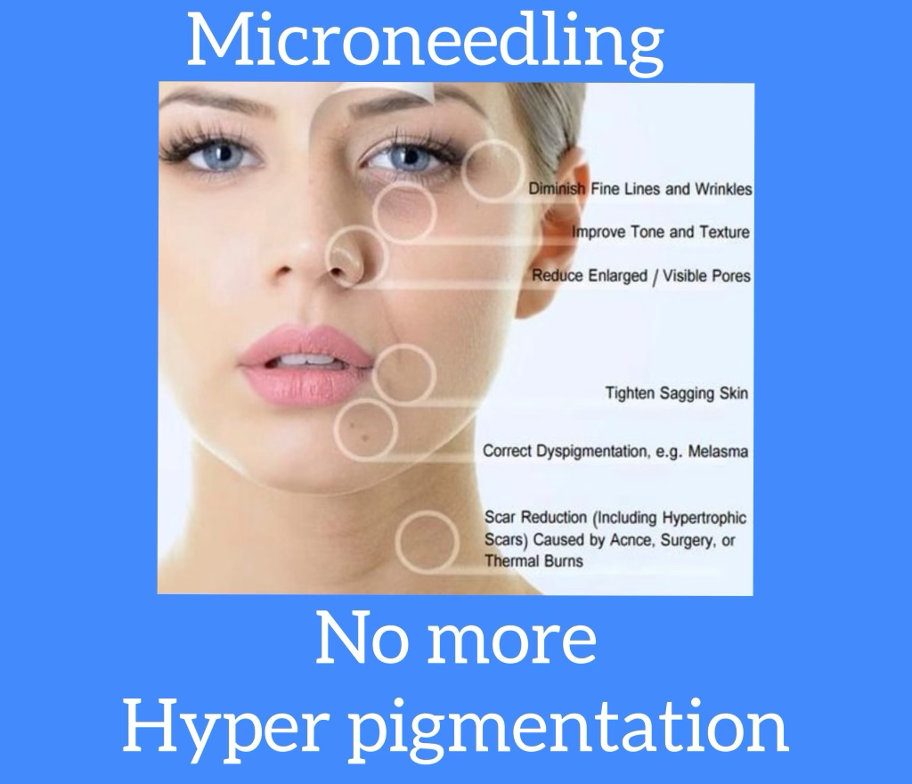 Microneedling Page 9.25.22
